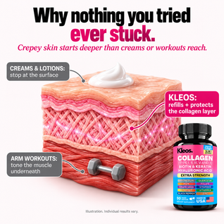 Kleos™ Deep Refill Collagen