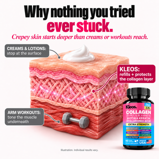 Kleos™ Deep Refill Collagen
